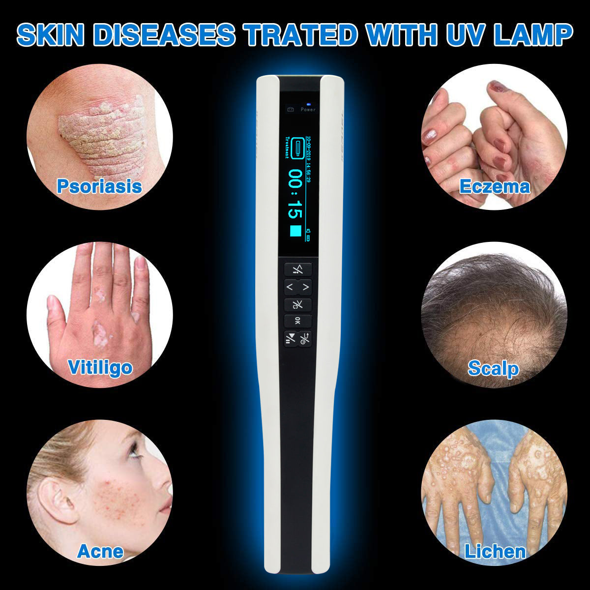 UVBMEDI Cordless UVB Lamp Phototherapy Light for Psoriasis Vitiligo Treatment Skin Disorders 311nm Narrow Band Home Use